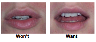 Curious Question #6 – Want vs. Won’t